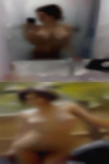 Swinging breast mature